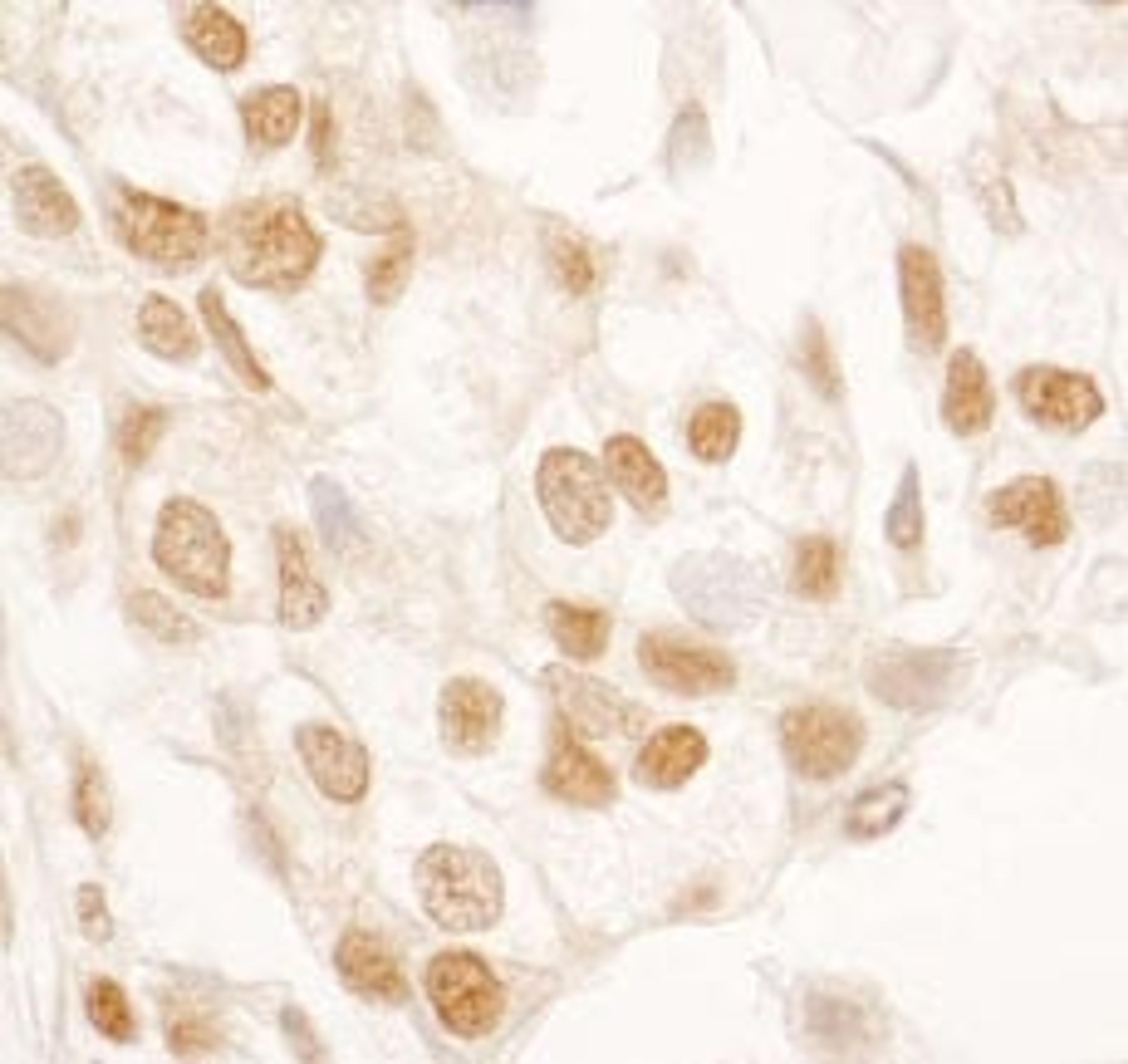 Detection of human SRcyp by immunohistochemistry.