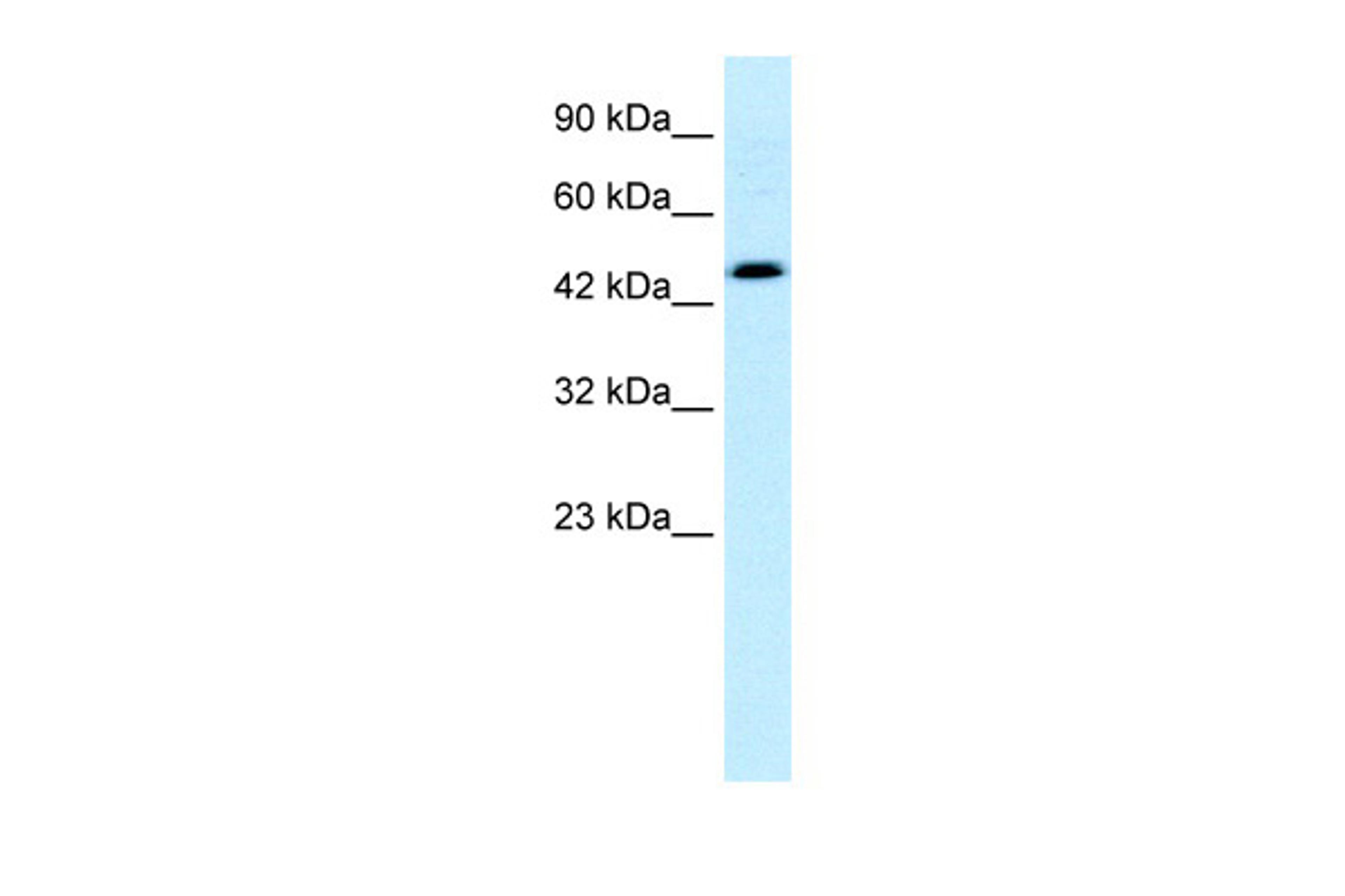 Antibody used in WB on Human HepG2 cells at 0.2-1 ug/ml.