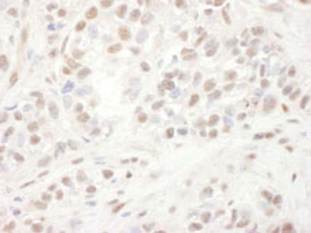 Detection of human ELK1 by immunohistochemistry.