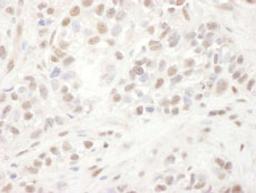 Detection of human ELK1 by immunohistochemistry.