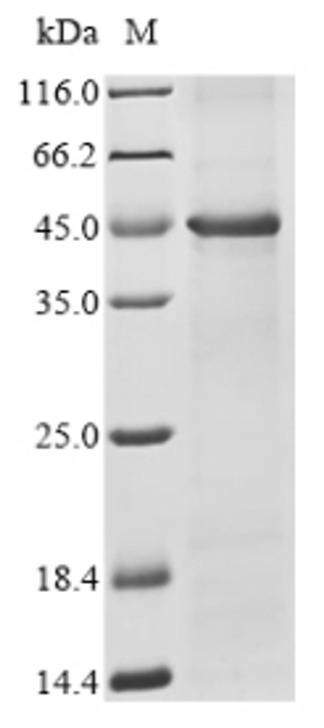 (Tris-Glycine gel) Discontinuous SDS-PAGE (reduced) with 5% enrichment gel and 15% separation gel.