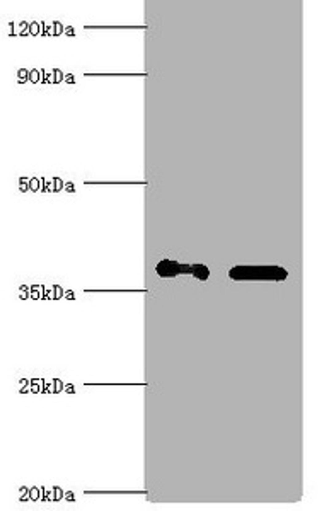 Western blot. All lanes: Aldo-keto reductase family 1 member C4 antibody at 7ug/ml. Lane 1: Hela whole cell lysate. Lane 2: HepG 2 whole cell lysate. Secondary. Goat polyclonal to rabbit IgG at 1/10000 dilution. Predicted band size: 37 kDa. Observed band size: 37 kDa.