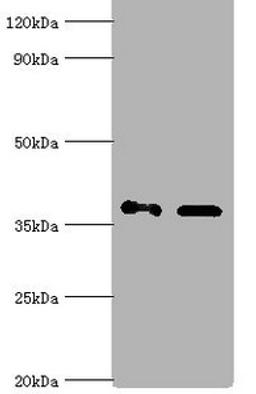 Western blot. All lanes: Aldo-keto reductase family 1 member C4 antibody at 7ug/ml. Lane 1: Hela whole cell lysate. Lane 2: HepG 2 whole cell lysate. Secondary. Goat polyclonal to rabbit IgG at 1/10000 dilution. Predicted band size: 37 kDa. Observed band size: 37 kDa.
