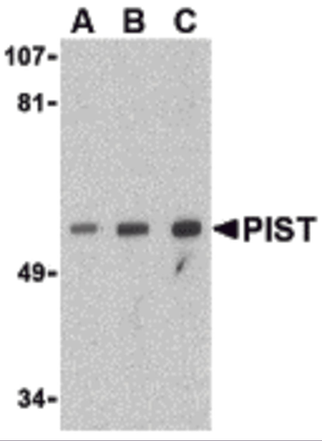 Western blot analysis of PIST in PC-3 cell lysate with PIST antibody at (A) 1, (B) 2 and (C) 4 μg/mL.