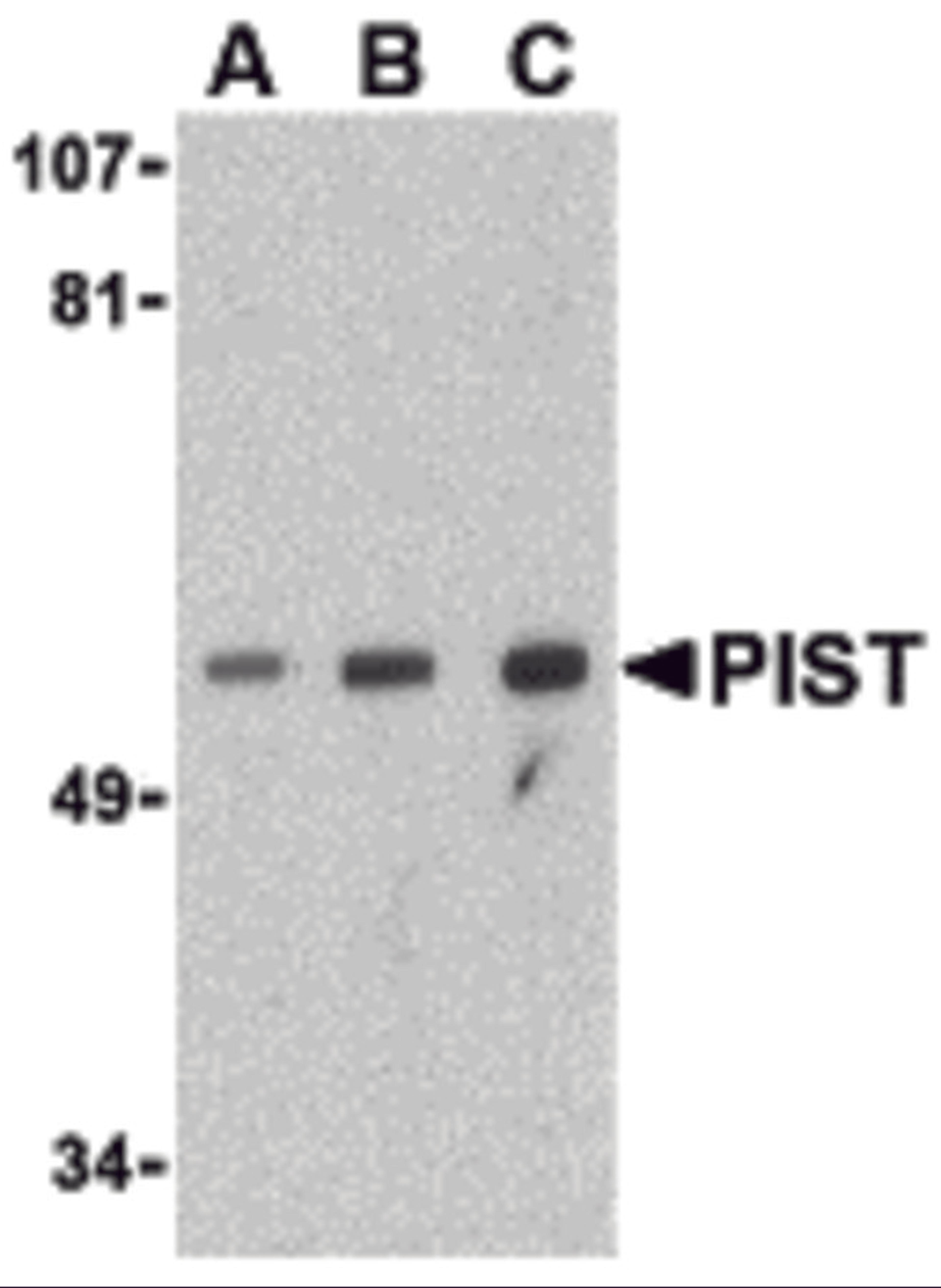 Western blot analysis of PIST in PC-3 cell lysate with PIST antibody at (A) 1, (B) 2 and (C) 4 μg/mL.