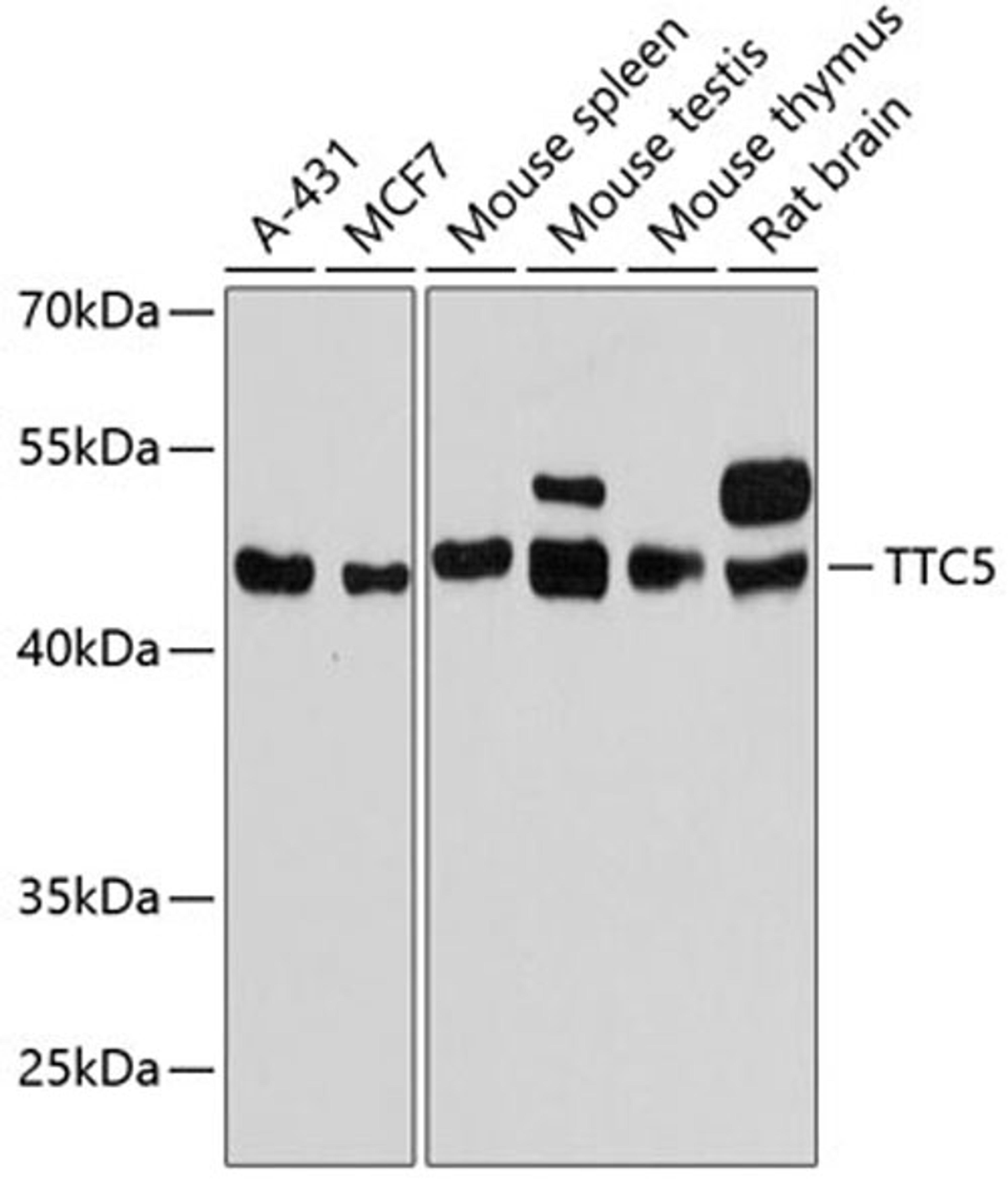 Western blot - TTC5 antibody (A13232)