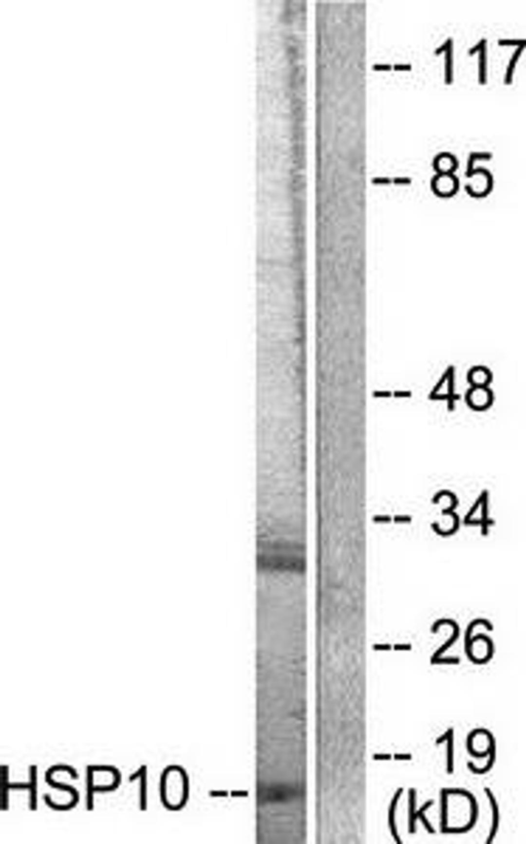 Western blot analysis of extracts from NIH/3T3 cells using HSP10 antibody