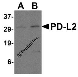 Western blot analysis of PD-L2 in Raji cell lysate with PD-L2 antibody at 0.5 and 1 &#956;g/mL.