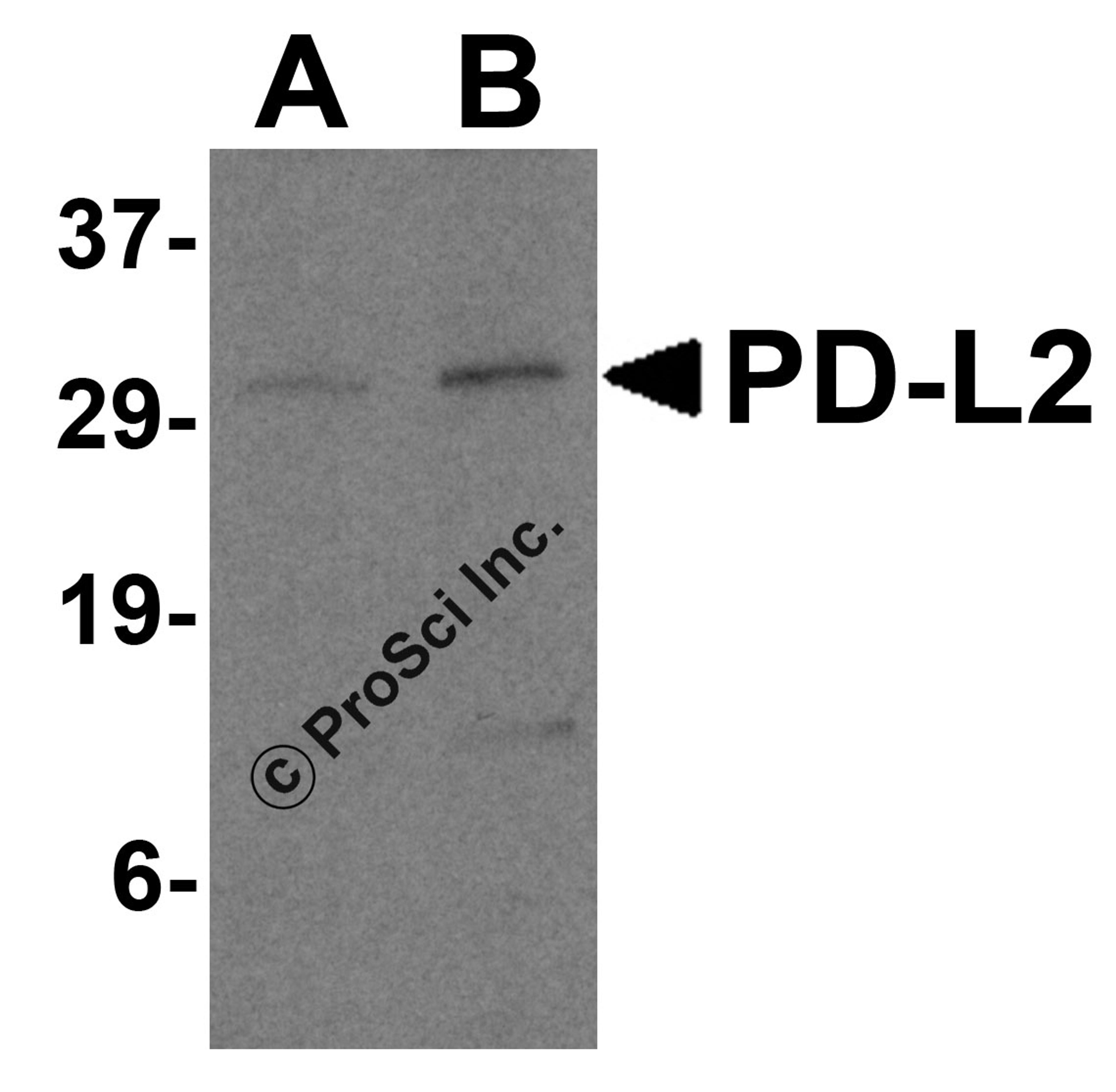 Western blot analysis of PD-L2 in Raji cell lysate with PD-L2 antibody at 0.5 and 1 &#956;g/mL.