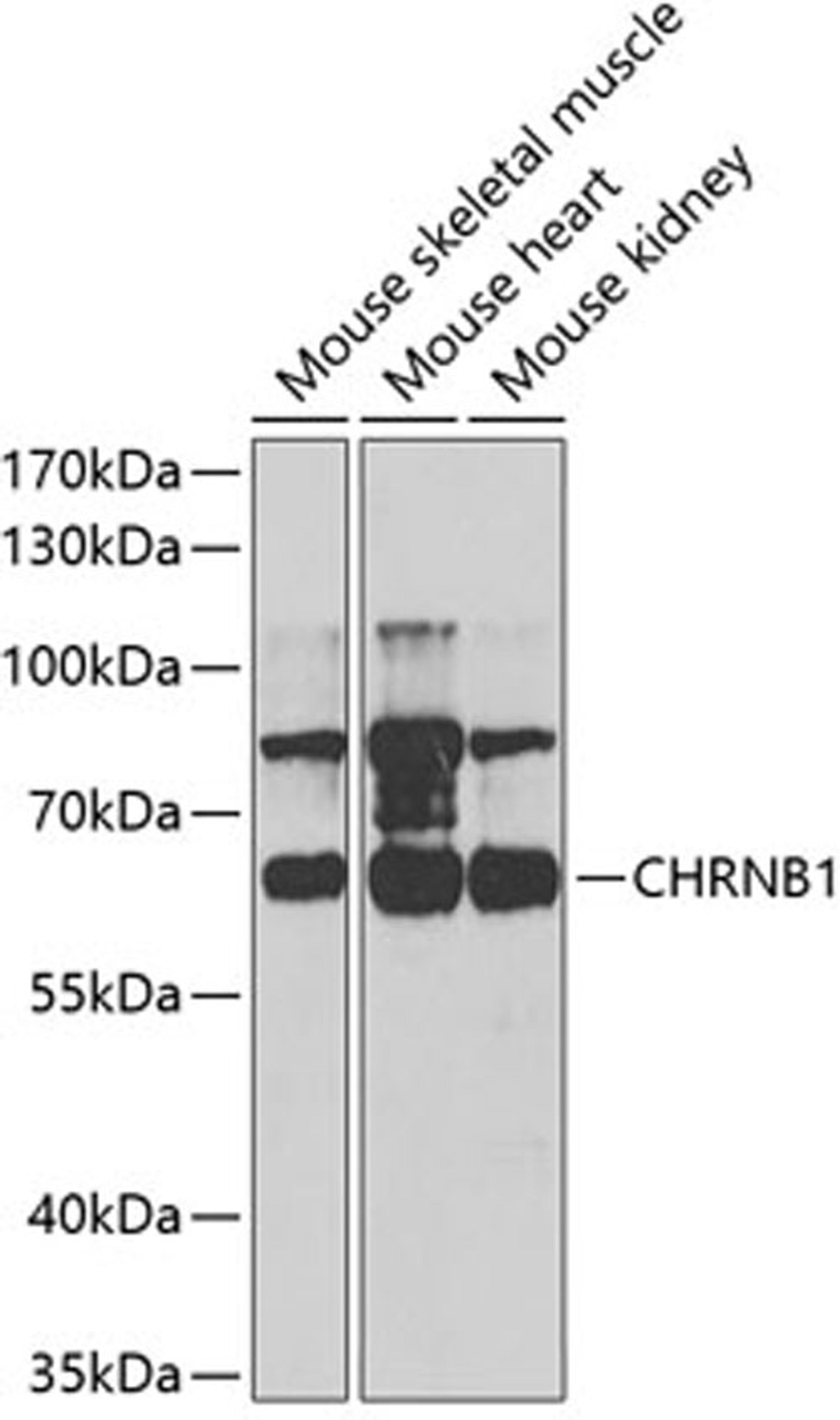 Western blot - CHRNB1 antibody (A5295)