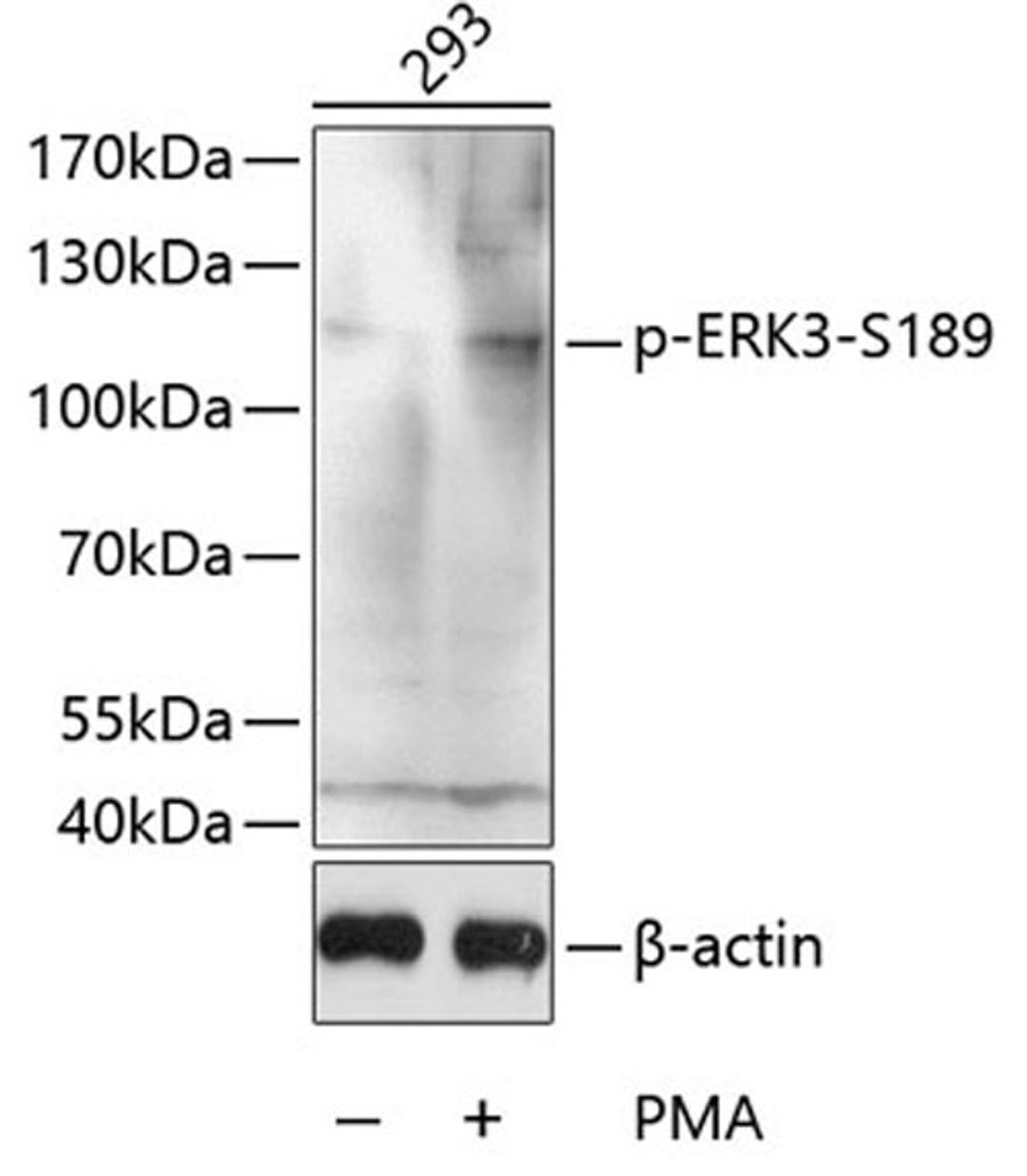 Western blot - Phospho-ERK3-S189 antibody (AP0051)