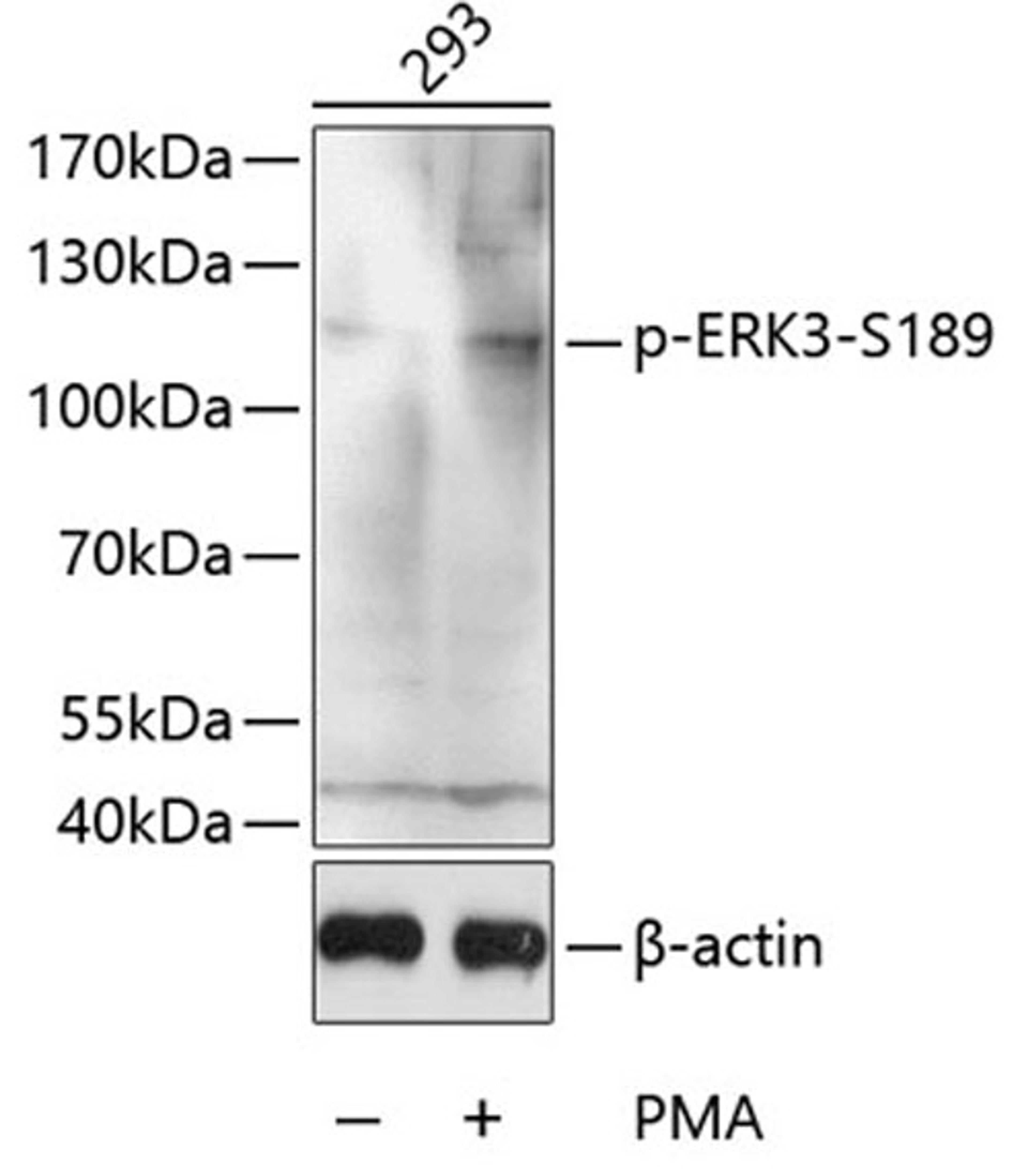 Western blot - Phospho-ERK3-S189 antibody (AP0051)