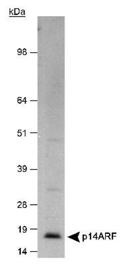 Western Blot: p14ARF Antibody [NB200-111] - Analysis of p14ARF Antibody in HeLa whole cell lysate (lot C).