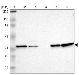 Western Blot: TXNL1 Antibody [NBP1-86899] - Lane 1: Marker [kDa] 230, 110, 82, 49, 32, 26, 18<br/>Lane 2: Human cell line RT-4<br/>Lane 3: Human cell line U-251MG sp<br/>Lane 4: Human plasma (IgG/HSA depleted)<br/>Lane 5: Human liver tissue<br/>Lane 6: Human tonsil tissue