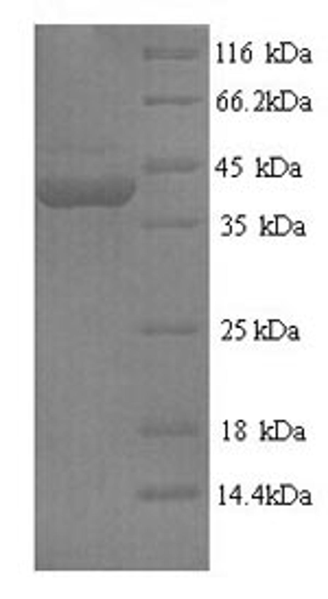 (Tris-Glycine gel) Discontinuous SDS-PAGE (reduced) with 5% enrichment gel and 15% separation gel.