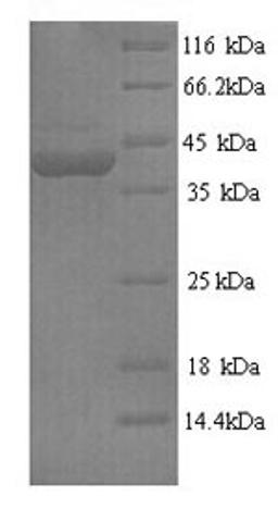(Tris-Glycine gel) Discontinuous SDS-PAGE (reduced) with 5% enrichment gel and 15% separation gel.