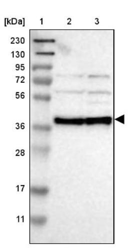 Western Blot: UIP1 Antibody [NBP1-86880] - Lane 1: Marker [kDa] 230, 130, 95, 72, 56, 36, 28, 17, 11<br/>Lane 2: Human cell line RT-4<br/>Lane 3: Human cell line U-251MG sp