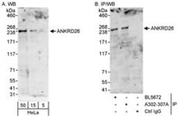 Detection of human ANKRD26 by western blot and immunoprecipitation.