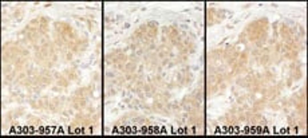 Detection of human EPRS by immunohistochemistry.