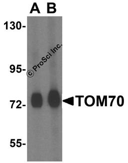 Western blot analysis of TOM70 in mouse brain tissue lysate with TOM70 antibody at (A) 0.5 and (B) 1 μg/mL.