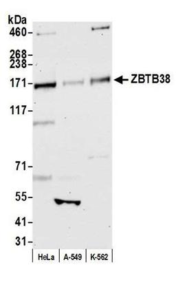 Detection of human ZBTB38 by WB.