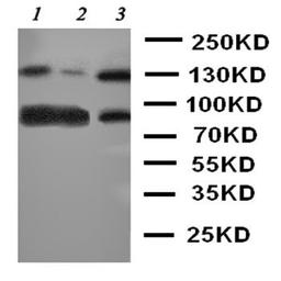 Western blot analysis of Lane 1: Rat Brain Tissue Lysate, Lane 2: Mouse Brain Tissue Lysate, Lane 3: U87 Cell Lysate using NTRK3 antibody