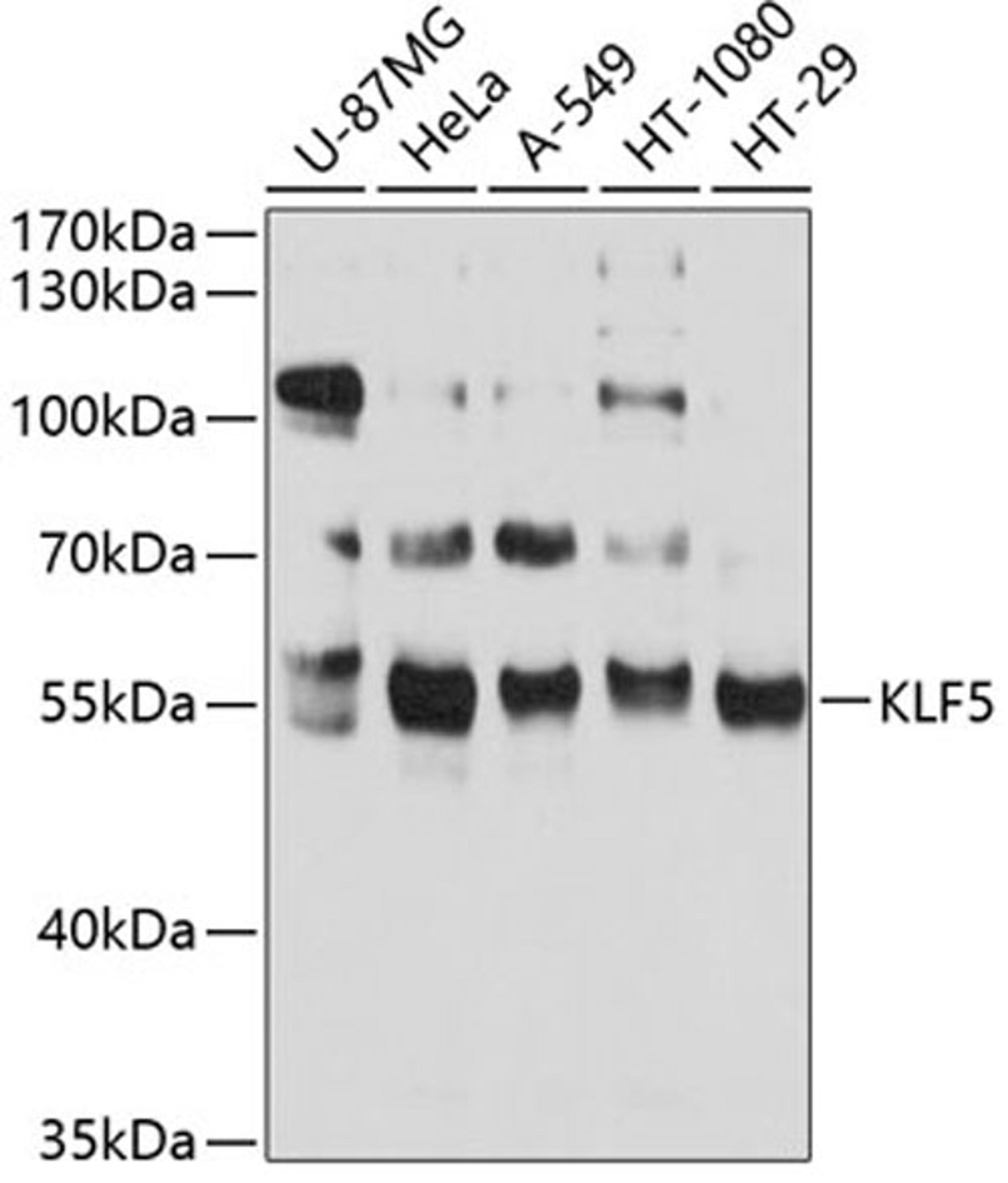 Western blot - KLF5 antibody (A2989)