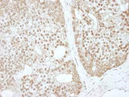 Detection of human ZBTB40 by immunohistochemistry.