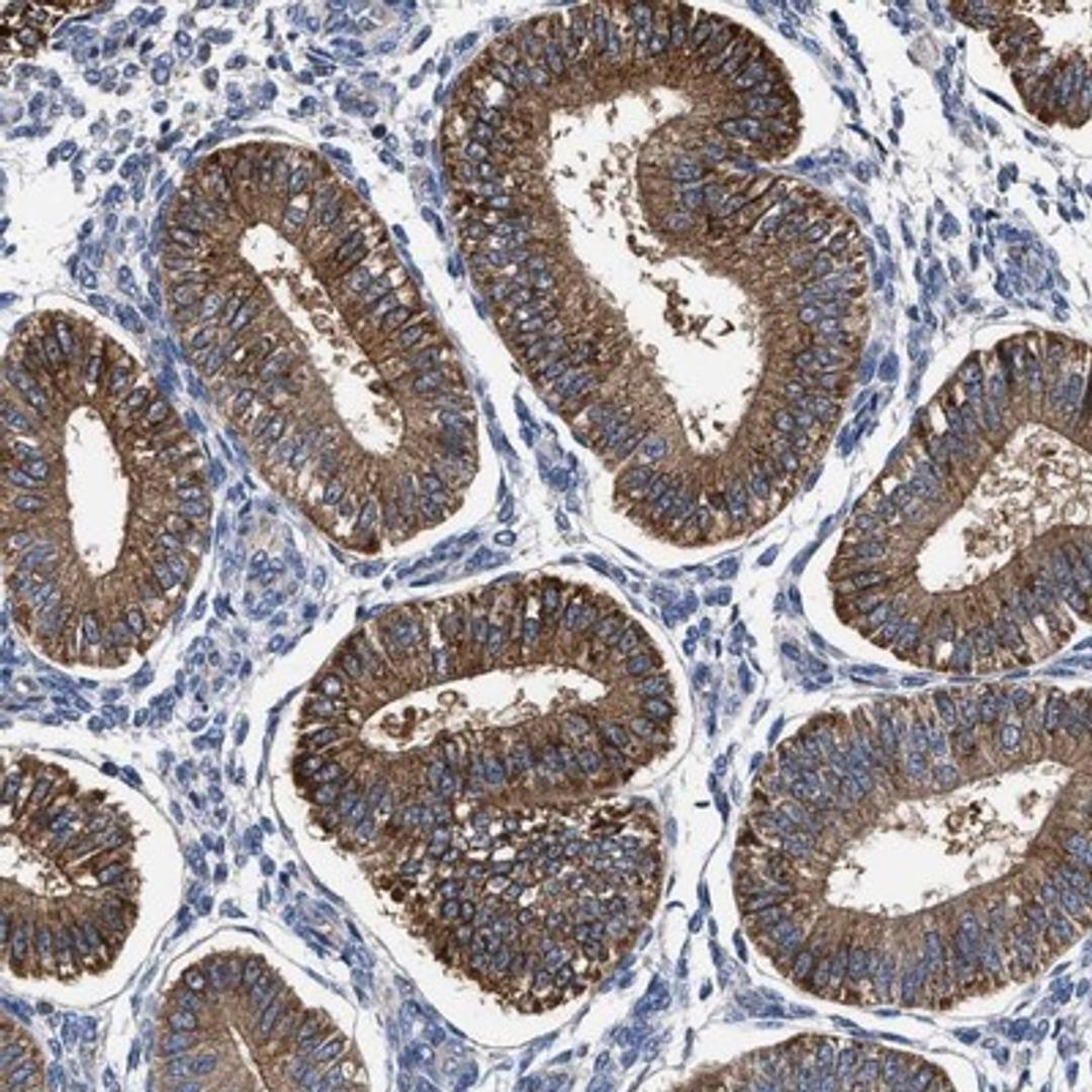 Immunohistochemistry-Paraffin: MACC1 Antibody [NBP1-89352] - Staining of human endometrium shows strong cytoplasmic positivity in glandular cells.