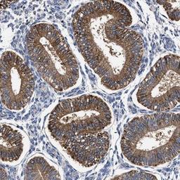 Immunohistochemistry-Paraffin: MACC1 Antibody [NBP1-89352] - Staining of human endometrium shows strong cytoplasmic positivity in glandular cells.