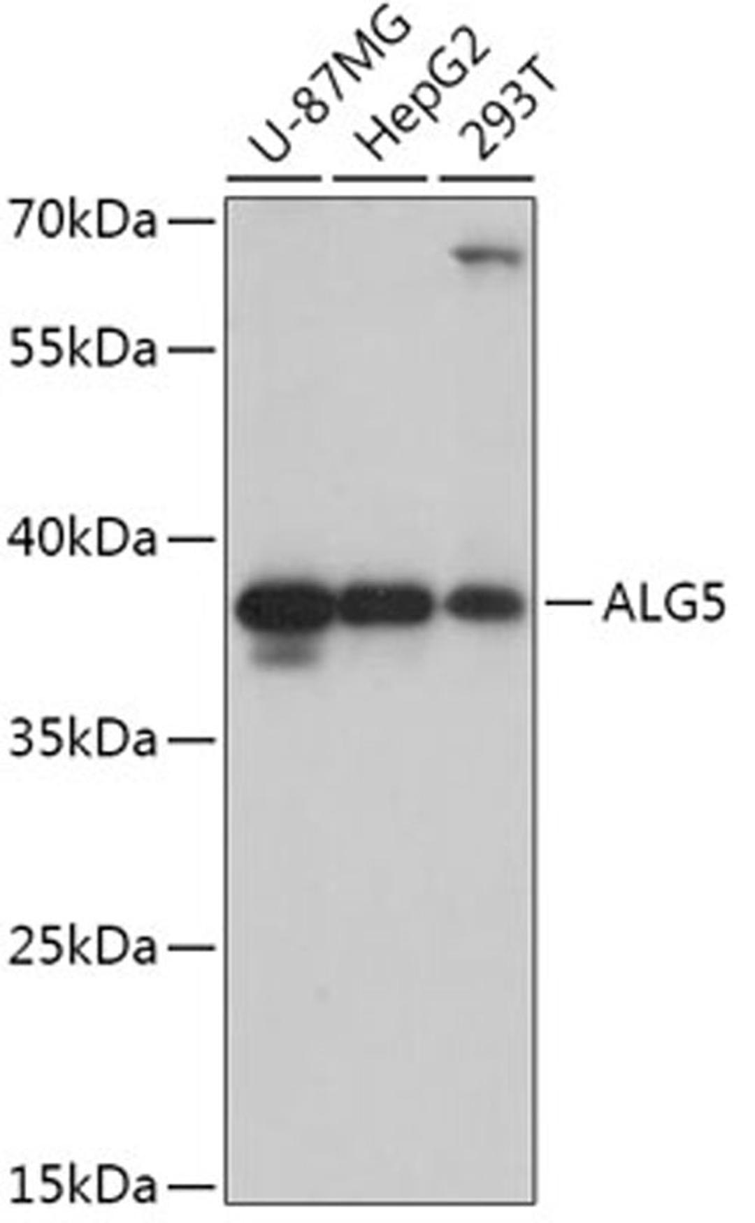 Western blot - ALG5 antibody (A17693)