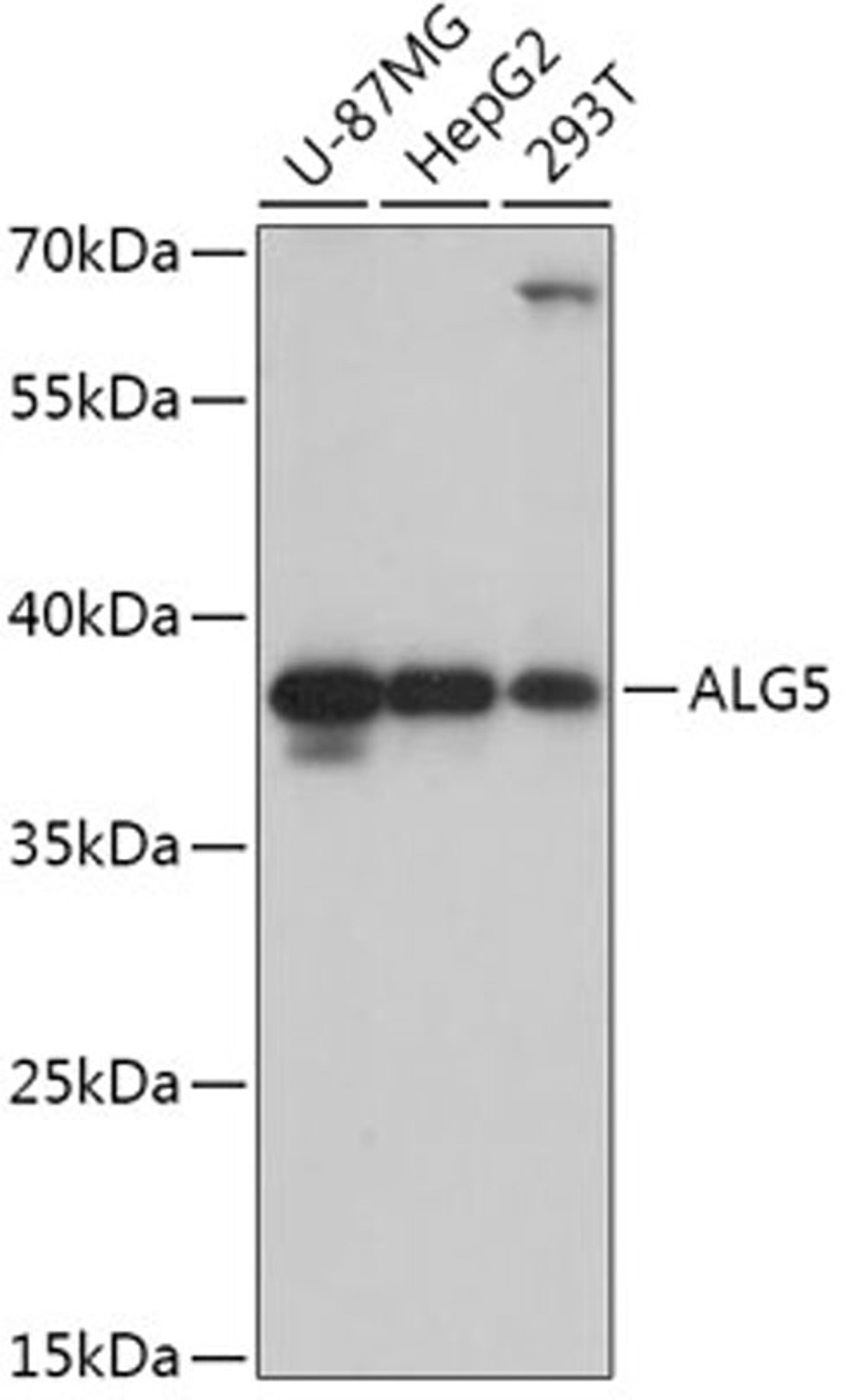 Western blot - ALG5 antibody (A17693)