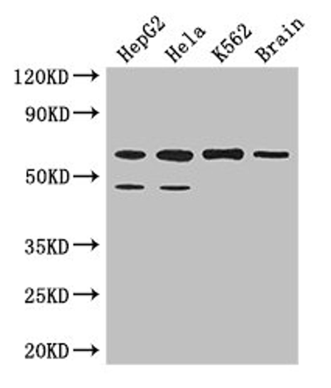 Western Blot. Positive WB detected in: HepG2 whole cell lysate, Hela whole cell lysate, K562 whole cell lysate, Mouse brain tissue. All lanes: PAF1 antibody at 3.2µg/ml. Secondary. Goat polyclonal to rabbit IgG at 1/50000 dilution. Predicted band size: 60, 56 kDa. Observed band size: 60, 48 kDa