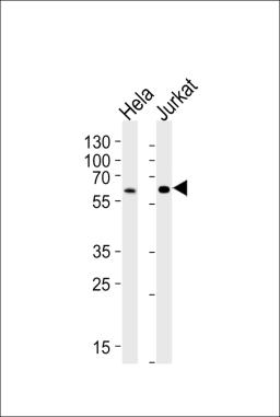 Western blot analysis of lysates from HeLa, Jurkat cell line (from left to right), using HPSE2 Antibody at 1:1000 at each lane.