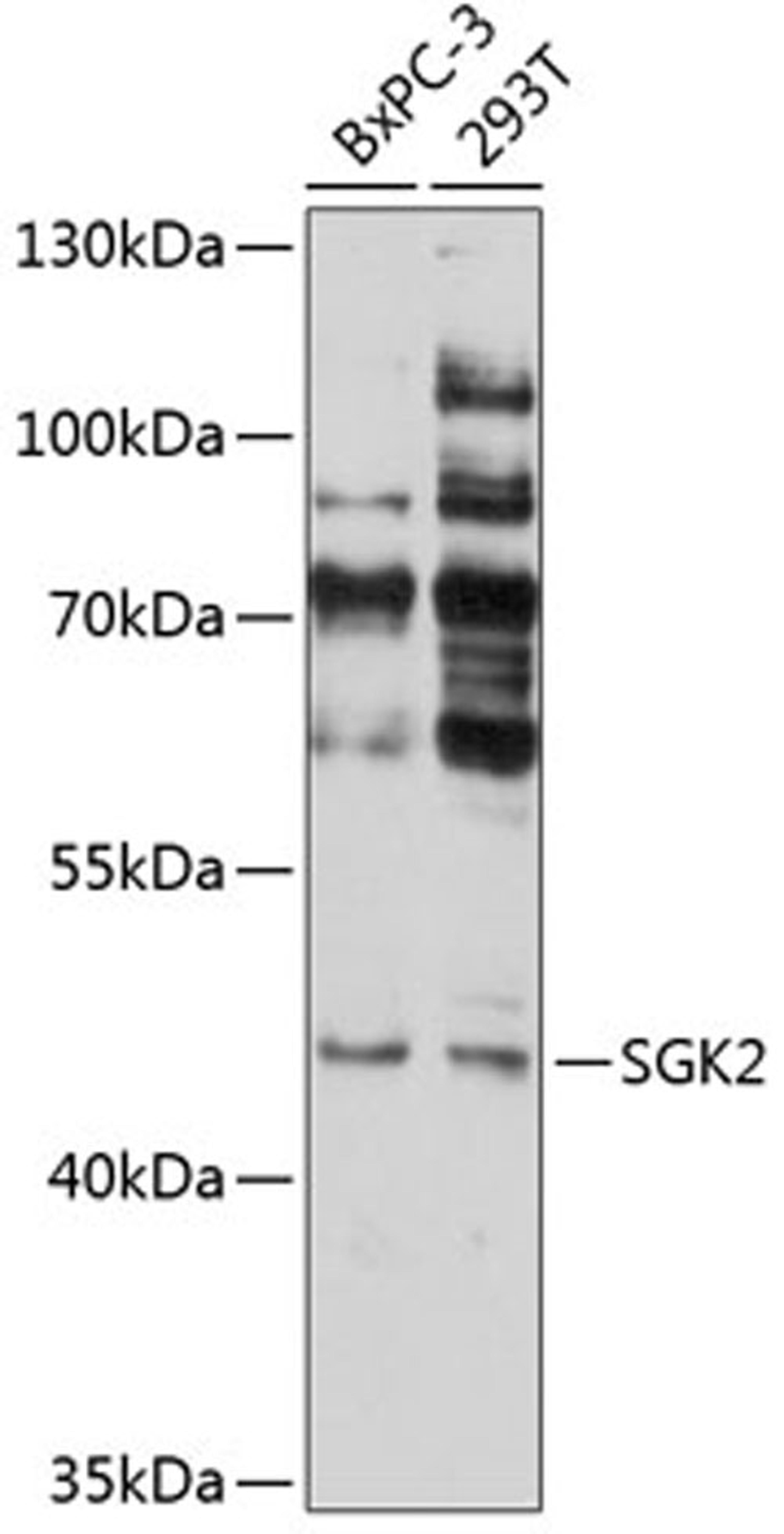 Western blot - SGK2 antibody (A12137)