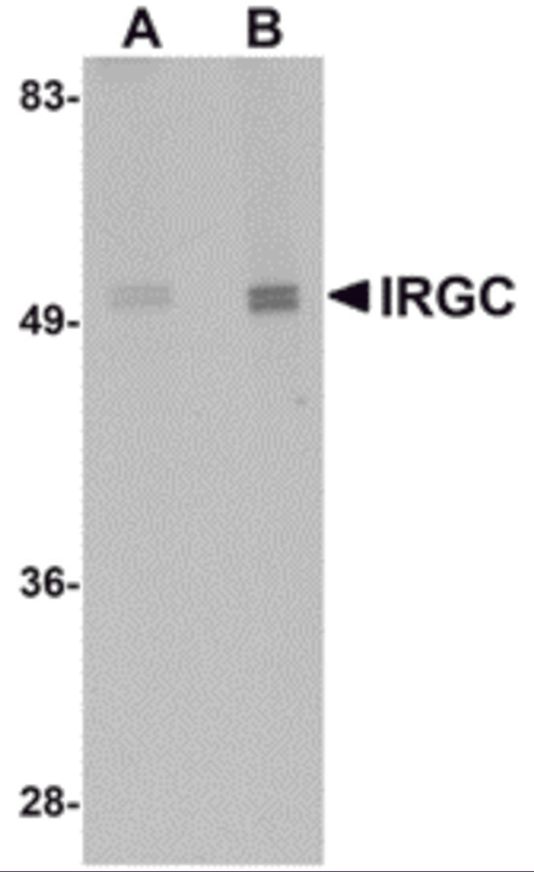 Western blot analysis of IRGC in mouse brain tissue lysate with IRGC antibody at (A) 1 and (B) 2 &#956;g/mL.