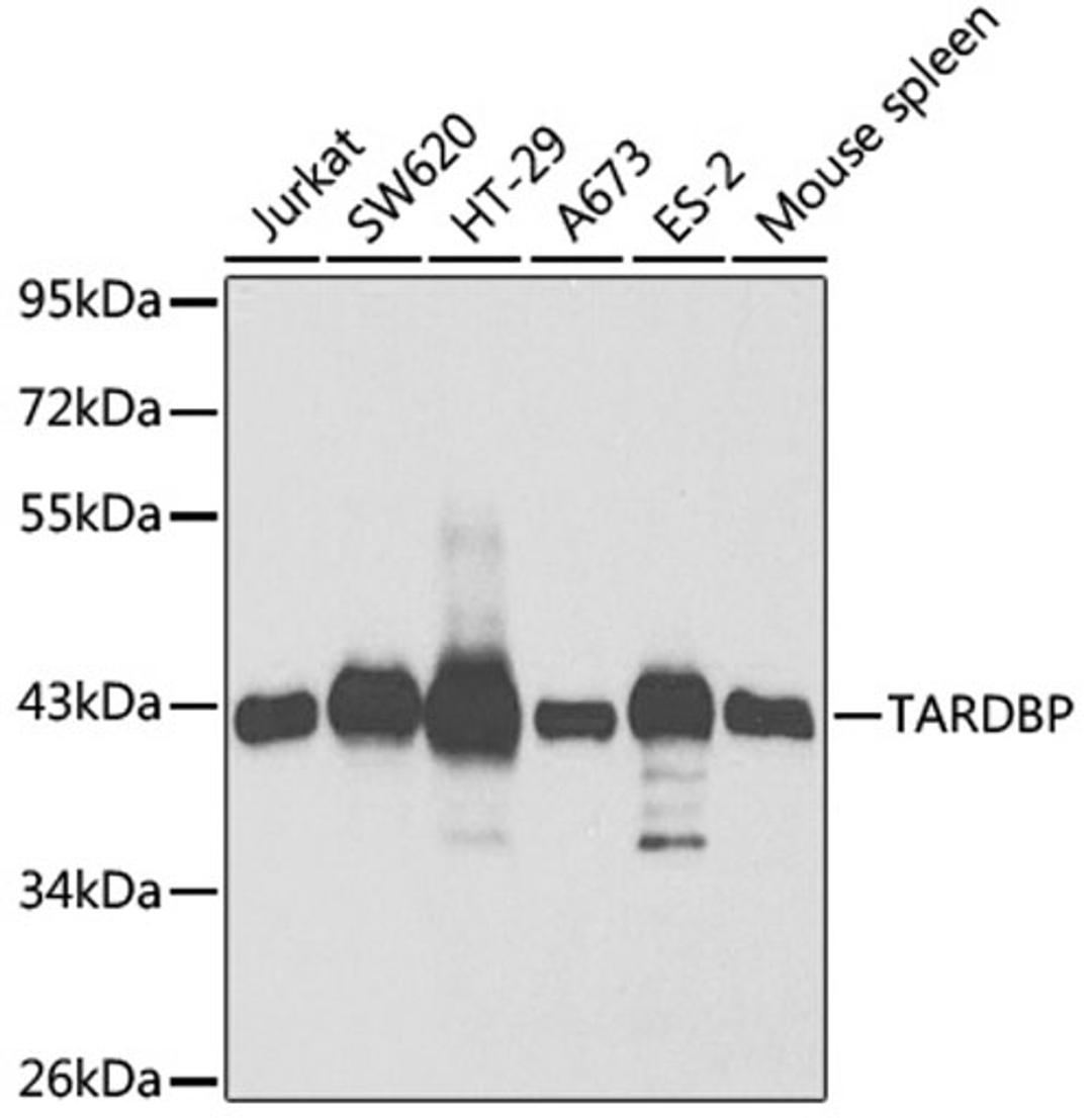 Western blot - TARDBP antibody (A1183)