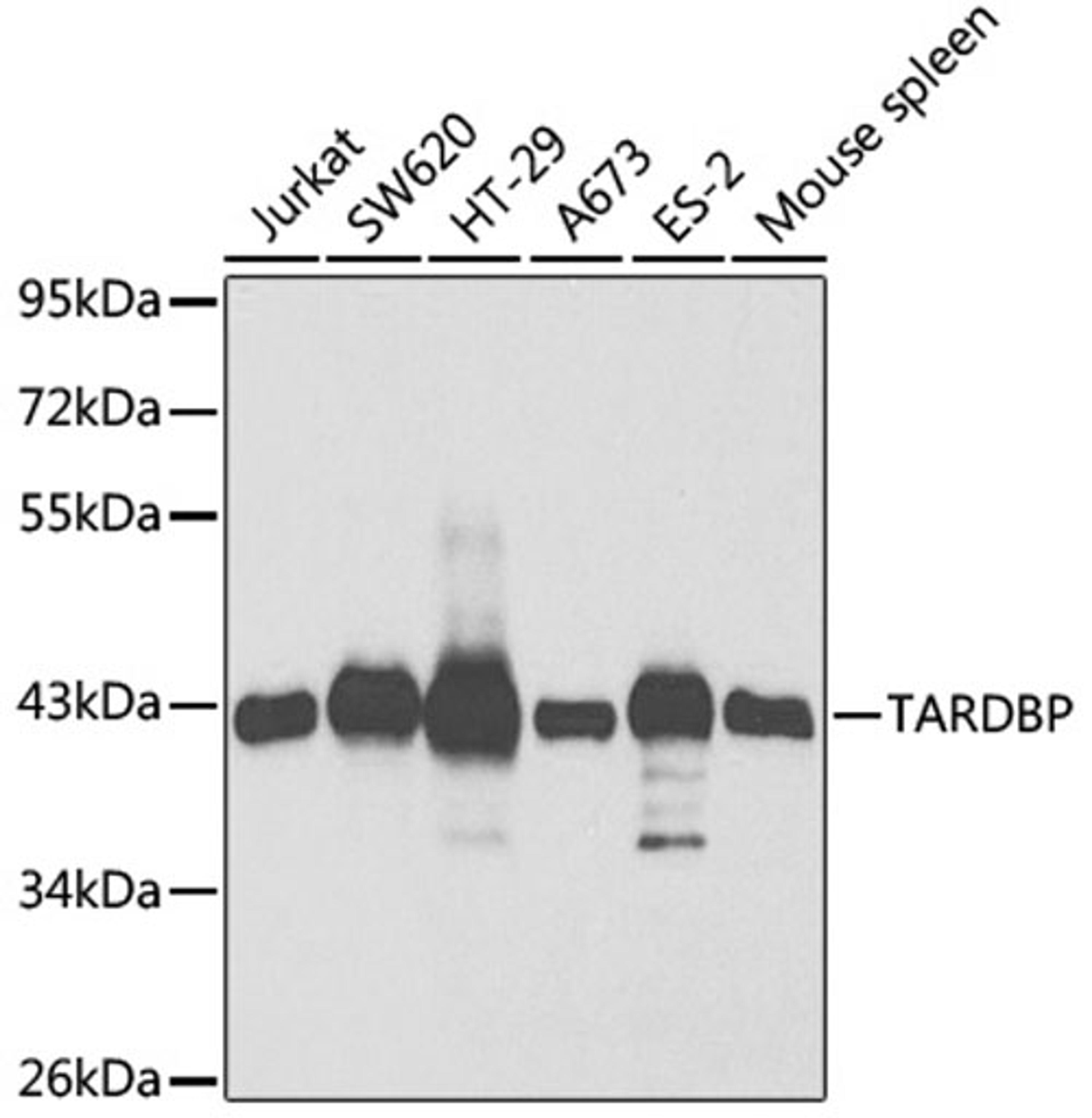 Western blot - TARDBP antibody (A1183)