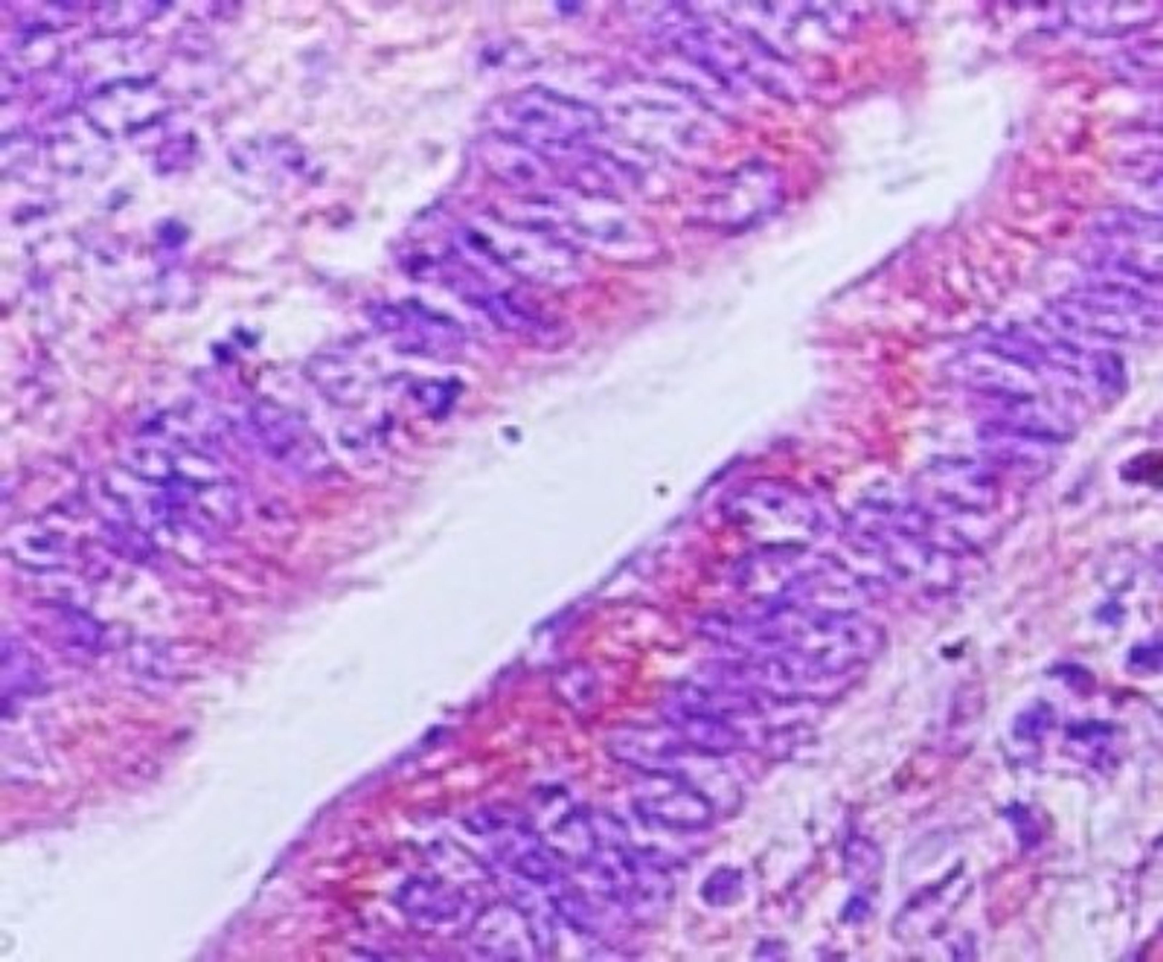 Immunohistochemistry-Paraffin: Viperin Antibody [NBP2-03971] - Analysis of viperin using viperin polyclonal antibody. Human rectum tissue probed with viperin antibody at 5 ug/ml.