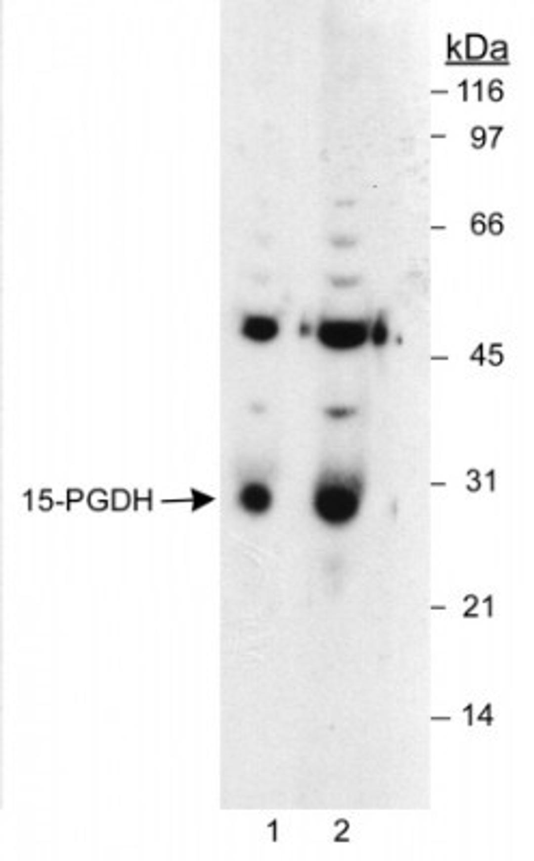 Western Blot: 15-PGDH/HPGD Antibody [NB200-179] - Analysis using the HRP conjugate of NB200-179. Detection of 15-PGDH in LoVo whole cell lysates using NB 200-179. Lane 1 uses a 1:6,000 dilution. Lane 2 uses a 1:1,500 dilution. ECL: 10 second exposure.