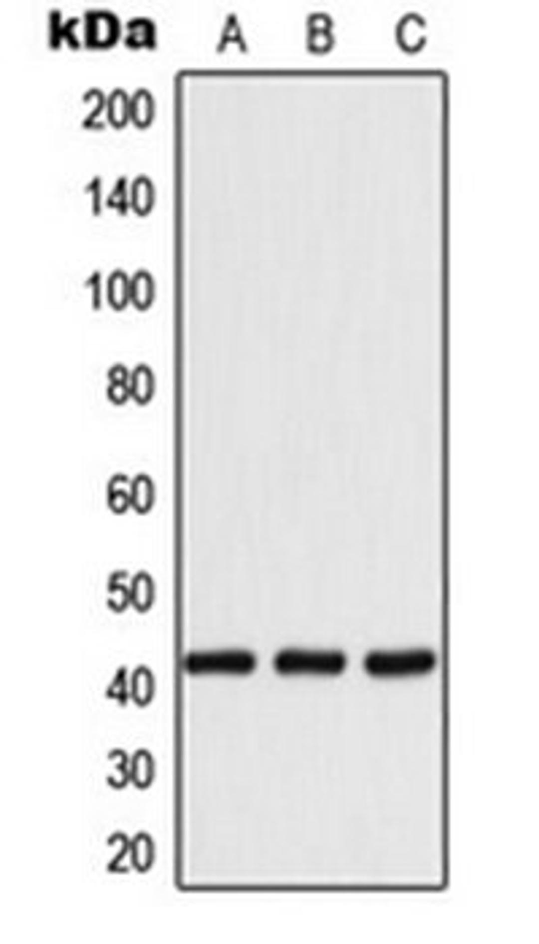 Western blot analysis of MCF7 (Lane 1), SP2/0 (Lane 2), H9C2 (Lane 3) whole cell lysates using 14-3-3 eta antibody