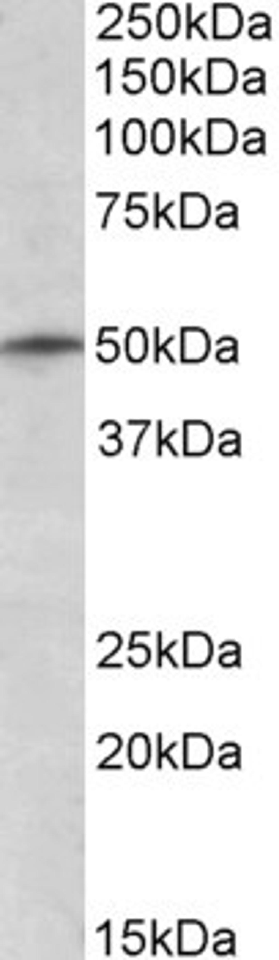 46-522 (1ug/ml) staining of K562 lysate (35ug protein in RIPA buffer). Primary incubation was 1 hour. Detected by chemiluminescence.