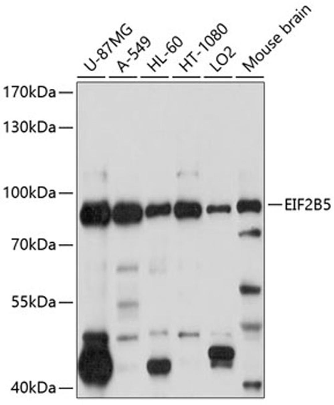 Western blot - EIF2B5 antibody (A10263)