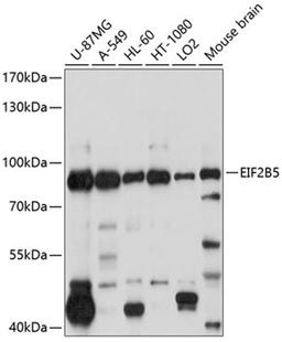 Western blot - EIF2B5 antibody (A10263)