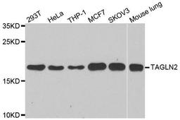 Western blot analysis of extracts of various cell lines using TAGLN2 antibody