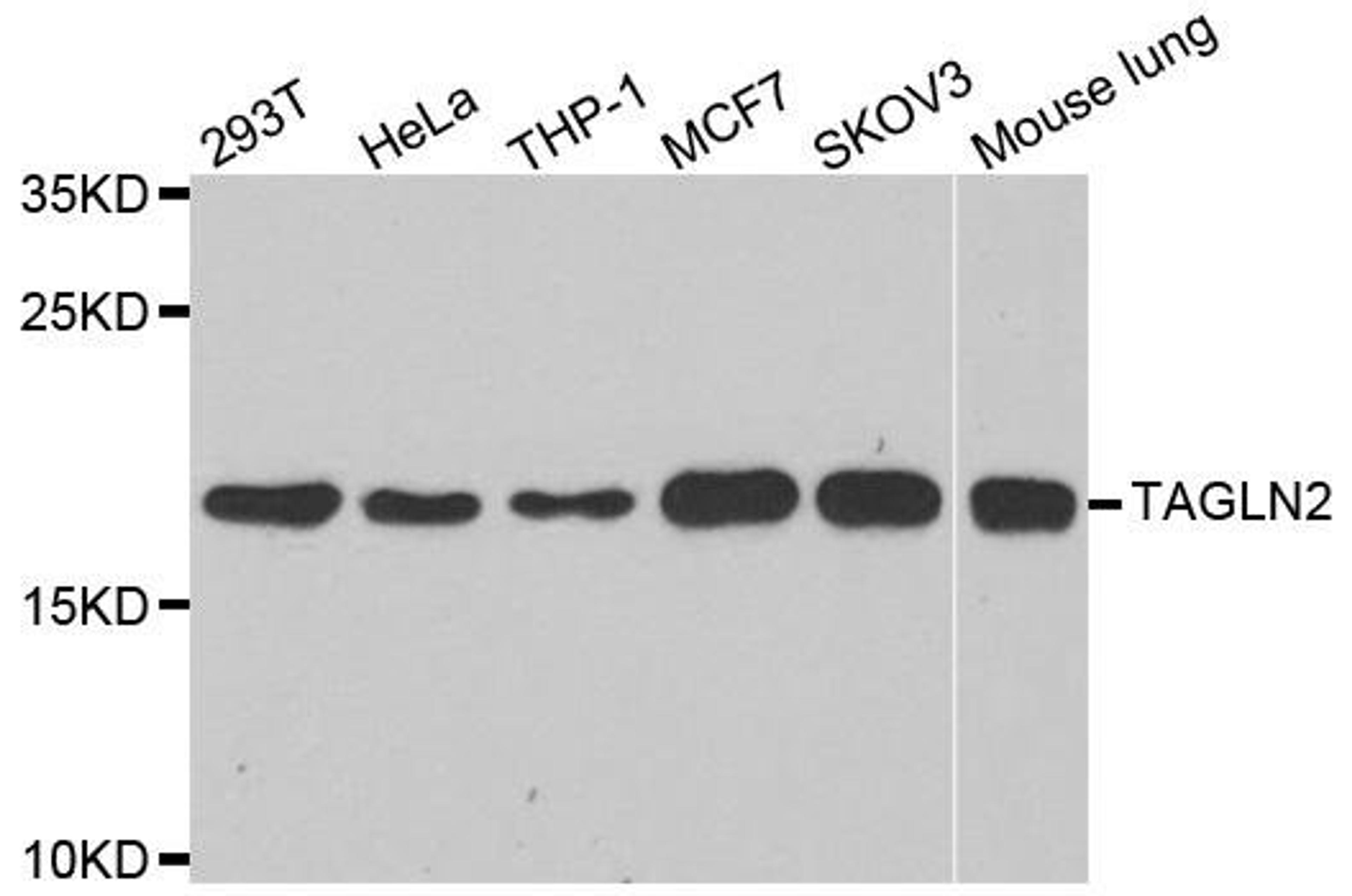 Western blot analysis of extracts of various cell lines using TAGLN2 antibody