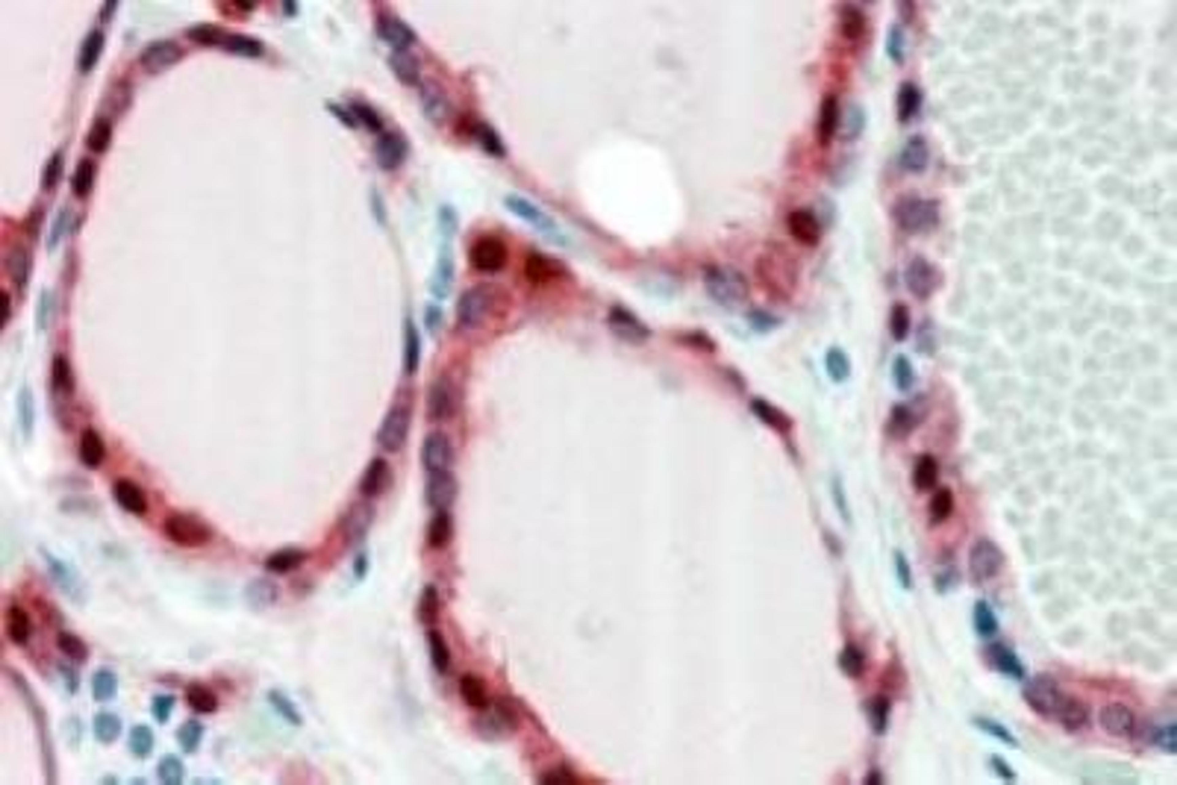 Immunohistochemistry-Paraffin: Frizzled-2 Antibody [NBP1-20920] - Staining of paraffin embedded Human Thyroid Gland. Steamed antigen retrieval with citrate buffer pH 6, AP-staining.