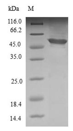 (Tris-Glycine gel) Discontinuous SDS-PAGE (reduced) with 5% enrichment gel and 15% separation gel.