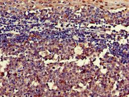 Immunohistochemistry of paraffin-embedded human tonsil tissue using CSB-PA019649LA01HU at dilution of 1:100