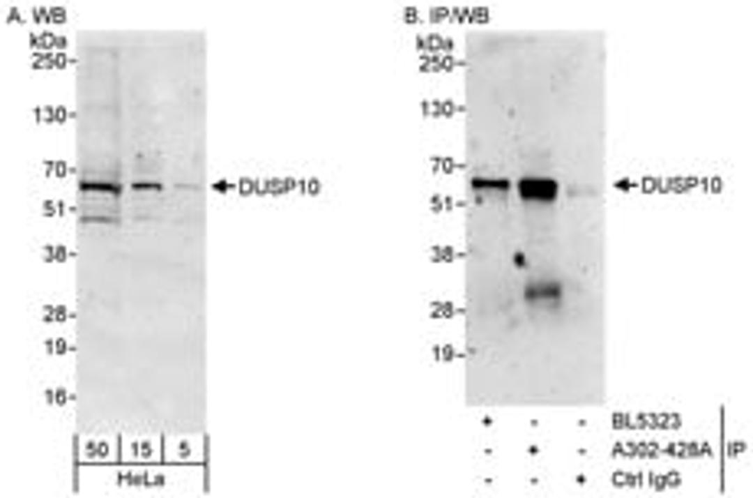 Detection of human DUSP10 by western blot and immunoprecipitation.